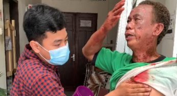 Bom Bunuh Diri, Potongan Tubuh Manusia Berserakan di Depan Gereja